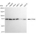 LifeSab™ KD-Validated PFKM Rabbit mAb (20 μl)