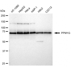 LifeSab™ KD-Validated PPM1G Rabbit mAb (20 μl)