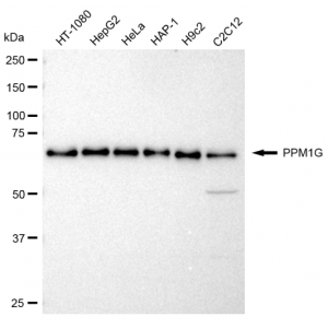 LifeSab™ KD-Validated PPM1G Rabbit mAb (20 μl)