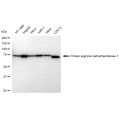 LifeSab™ KD-Validated PRMT7 Rabbit mAb (20 μl)