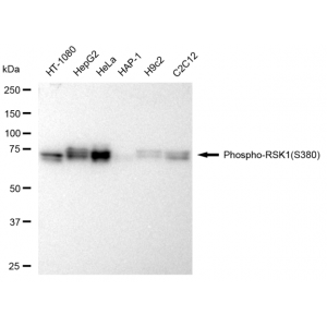 LifeSab™ KD-Validated Phospho-RSK1 (S380) Rabbit mAb (20 μl)