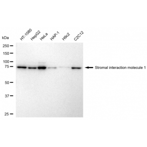 LifeSab™ KD-Validated STIM1 Rabbit mAb (20 μl)