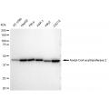 LifeSab™ KD-Validated ACAA2 Rabbit mAb (20 μl)