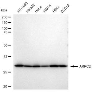 LifeSab™ KD-Validated ARPC2 Rabbit mAb (20 μl)