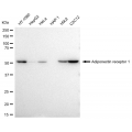 LifeSab™ KD-Validated ADIPOR1 Rabbit mAb (20 μl)