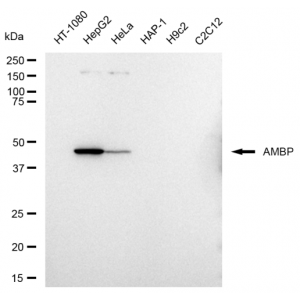 LifeSab™ KD-Validated AMBP Rabbit mAb (20 μl)