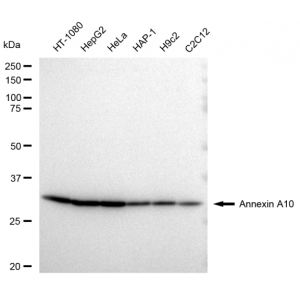 LifeSab™ KD-Validated ANXA10 Rabbit mAb (20 μl)