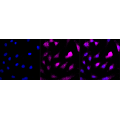 LifeSab™ KD-Validated AP2M1 Rabbit mAb (20 μl)