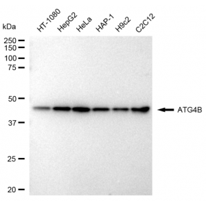 LifeSab™ KD-Validated ATG4B Rabbit mAb (20 μl)