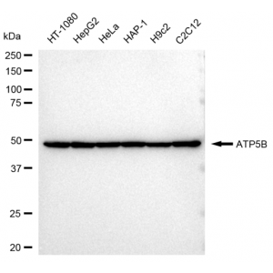 LifeSab™ KD-Validated ATP5B Rabbit mAb (20 μl)