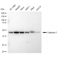 LifeSab™ KD-Validated CASP2 Rabbit mAb (20 μl)