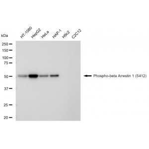 LifeSab™ KD-Validated Phospho-ARRB1 (S412) Rabbit mAb (20 μl)