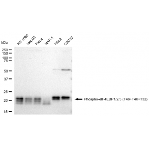 LifeSab™ KD-Validated Phospho-eIF4EBP1/2/3 (T46+T46+T32) Rabbit mAb (20 μl)