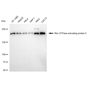 LifeSab™ KD-Validated ARHGAP5 Rabbit mAb (20 μl)