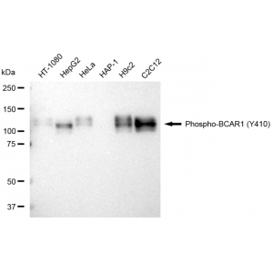 LifeSab™ KD-Validated Phospho-BCAR1 (Y410) Rabbit mAb (20 μl)