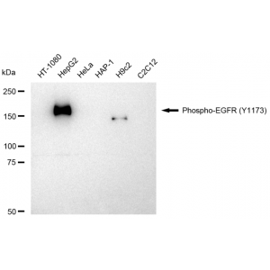 LifeSab™ KD-Validated Phospho-EGFR (Y1173) Rabbit mAb (20 μl)