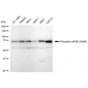 LifeSab™ KD-Validated Phospho-eIF4B (S406) Rabbit mAb (20 μl)