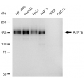 LifeSab™ KD-Validated ATP7B Rabbit mAb (20 μl)