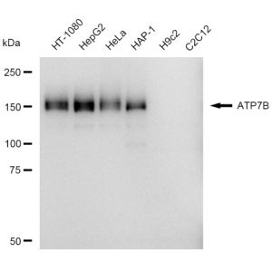 LifeSab™ KD-Validated ATP7B Rabbit mAb (20 μl)