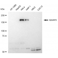 LifeSab™ KD-Validated IQGAP2 Rabbit mAb (20 μl)