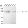 LifeSab™ KD-Validated Phospho-PKCA (T638) Rabbit mAb (20 μl)