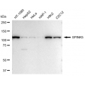 LifeSab™ KD-Validated SPINK5 Rabbit mAb (20 μl)