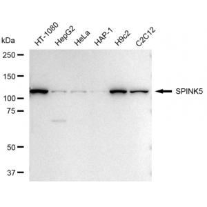 LifeSab™ KD-Validated SPINK5 Rabbit mAb (20 μl)