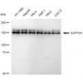 LifeSab™ KD-Validated SUPT5H Rabbit mAb (20 μl)