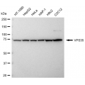 LifeSab™ KD-Validated VPS35 Rabbit mAb (20 μl)