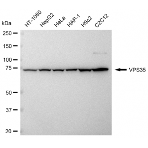 LifeSab™ KD-Validated VPS35 Rabbit mAb (20 μl)