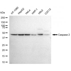 LifeSab™ KD-Validated CASP2 Rabbit mAb (20 μl)