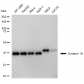 LifeSab™ KD-Validated STX16 Rabbit mAb (20 μl)