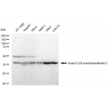 LifeSab™ KD-Validated ACAT2 Rabbit mAb (20 μl)