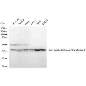 LifeSab™ KD-Validated ACAT2 Rabbit mAb (20 μl)