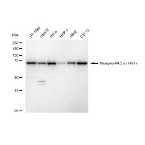 LifeSab™ KD-Validated Phospho-PKCA (T497) Rabbit mAb (20 μl)