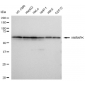 LifeSab™ KD-Validated HNRNPK Rabbit mAb (20 μl)