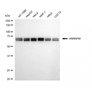 LifeSab™ KD-Validated HNRNPM Rabbit mAb (20 μl)