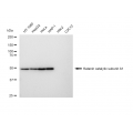 LifeSab™ KD-Validated KATNA1 Rabbit mAb (20 μl)