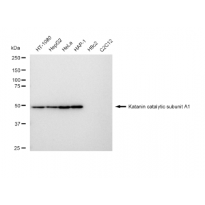 LifeSab™ KD-Validated KATNA1 Rabbit mAb (20 μl)