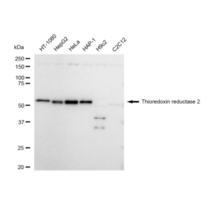 LifeSab™ KD-Validated TXNRD2 Rabbit mAb (20 μl)