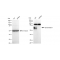 LifeSab™ KD-Validated BACE1 Rabbit mAb (20 μl)