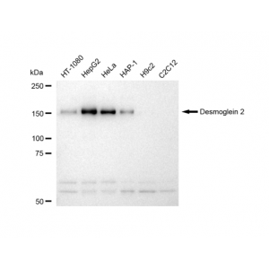 LifeSab™ KD-Validated DSG2 Rabbit mAb (20 μl)