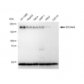 LifeSab™ KD-Validated EIF2AK4 Rabbit mAb (20 μl)