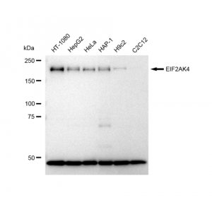 LifeSab™ KD-Validated EIF2AK4 Rabbit mAb (20 μl)