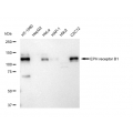 LifeSab™ KD-Validated EPHB1 Rabbit mAb (20 μl)