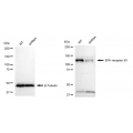 LifeSab™ KD-Validated EPHB1 Rabbit mAb (20 μl)