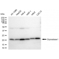 LifeSab™ KD-Validated GLO1 Rabbit mAb (20 μl)