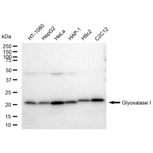 LifeSab™ KD-Validated GLO1 Rabbit mAb (20 μl)