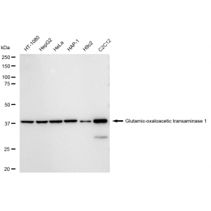 LifeSab™ KD-Validated GOT1 Rabbit mAb (20 μl)