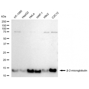 LifeSab™ KD-Validated B2M Rabbit mAb (20 μl)